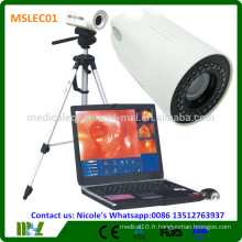 MSLEC01i New Tech Medical colposcope numérique / colposcope vidéo vagin